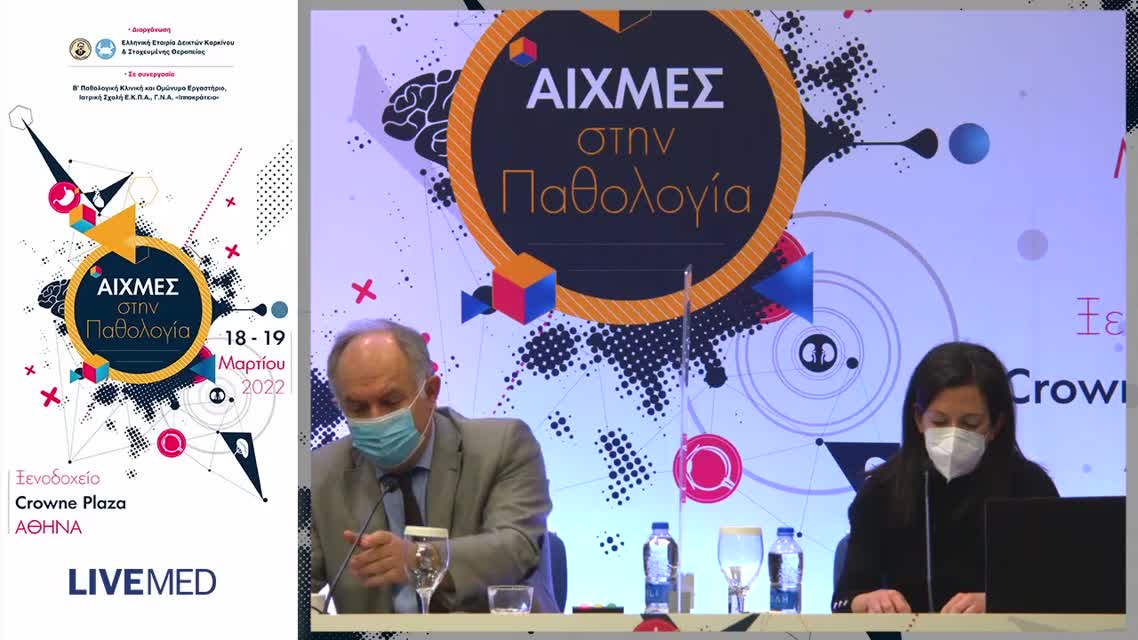 33 Μποκή Κ. - Μυοσίτιδες: Τι αλλάζει στην διάγνωση και θεραπεία τους; 