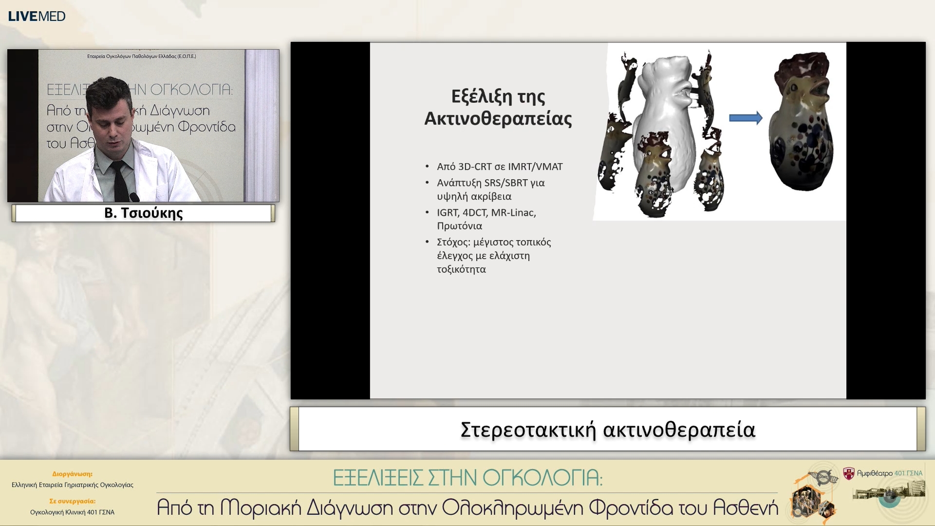 05 Β. Τσιούκης - Στερεοτακτική ακτινοθεραπεία 