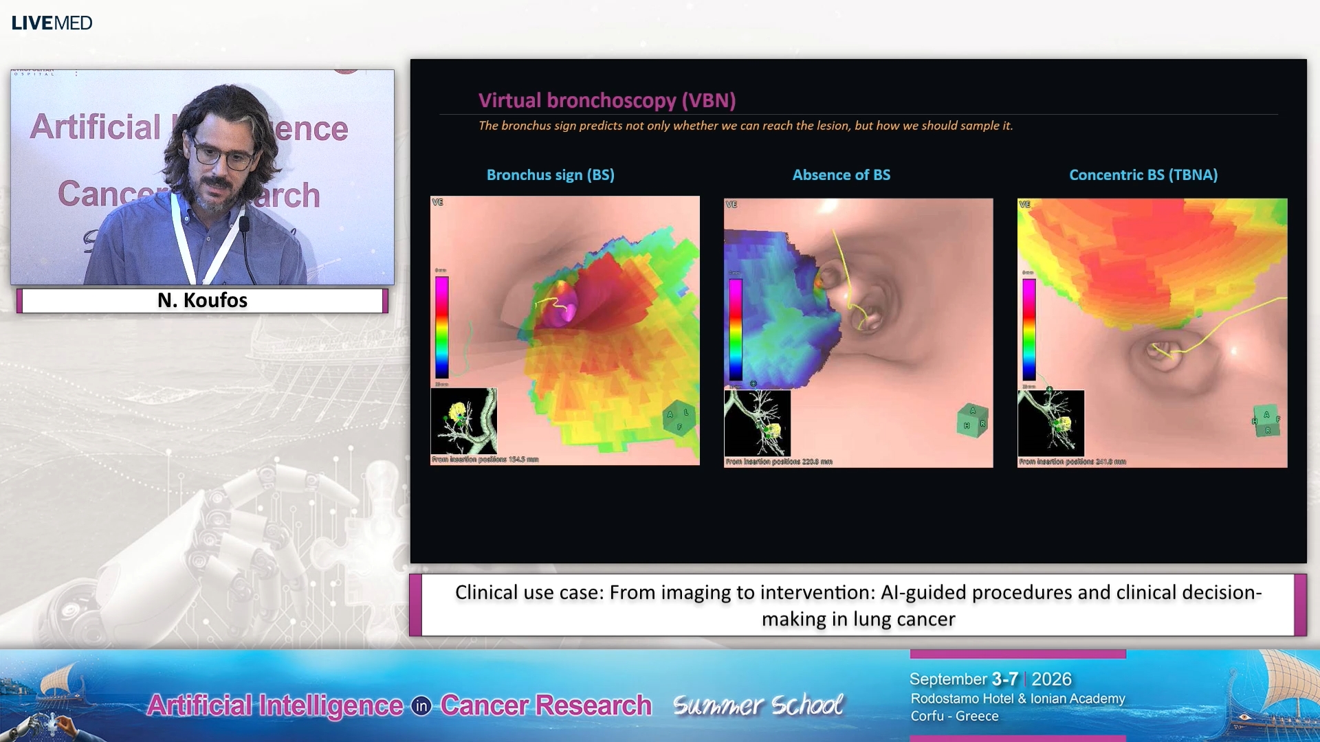 20  N. Koufos  - Clinical use case: From imaging to intervention: AI-guided procedures and clinical decision-making in lung cancer