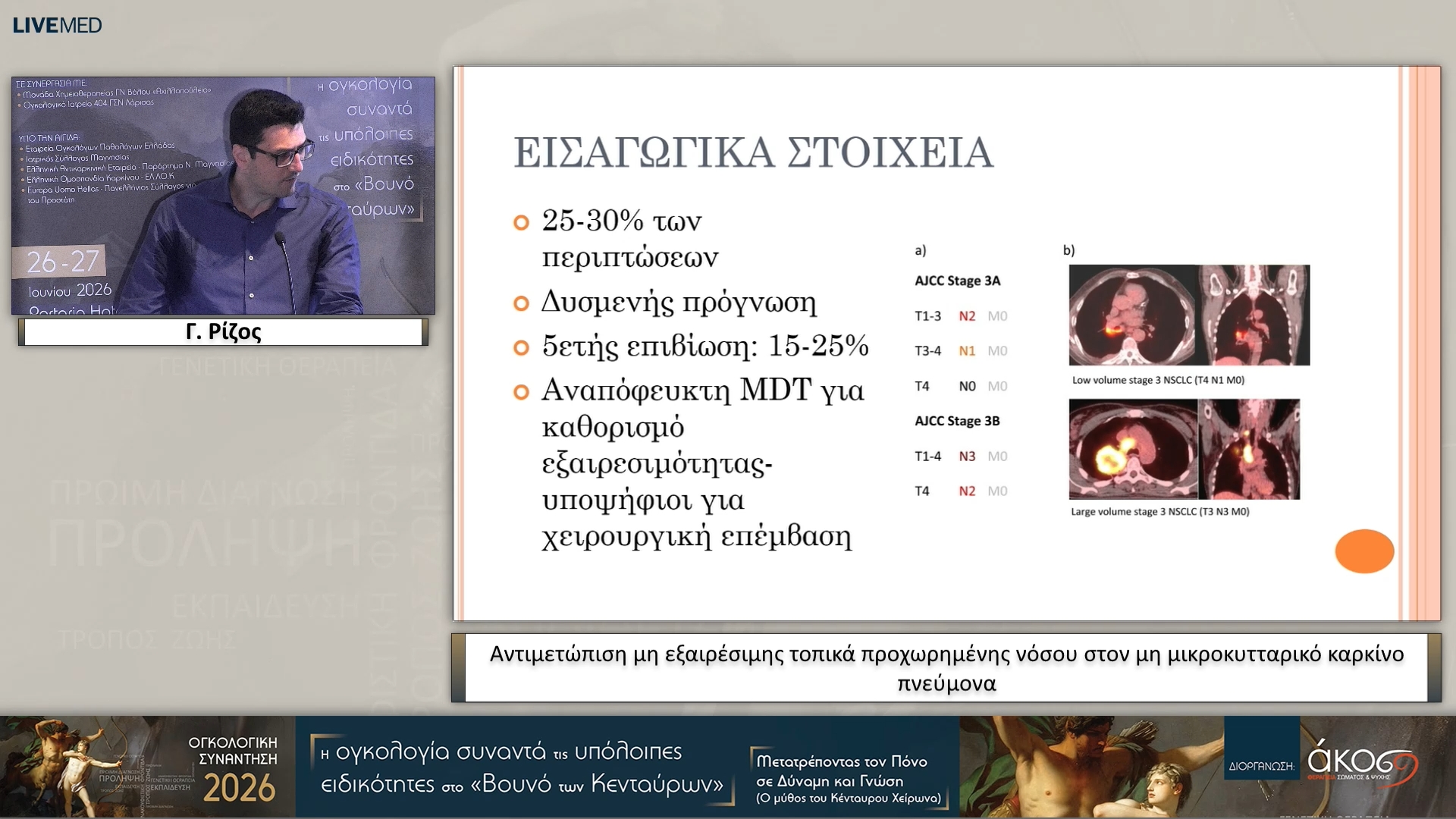 47 Γ. Ρίζος - Αντιμετώπιση μη εξαιρέσιμης τοπικά προχωρημένης νόσου στον μη μικροκυτταρικό καρκίνο πνεύμονα 