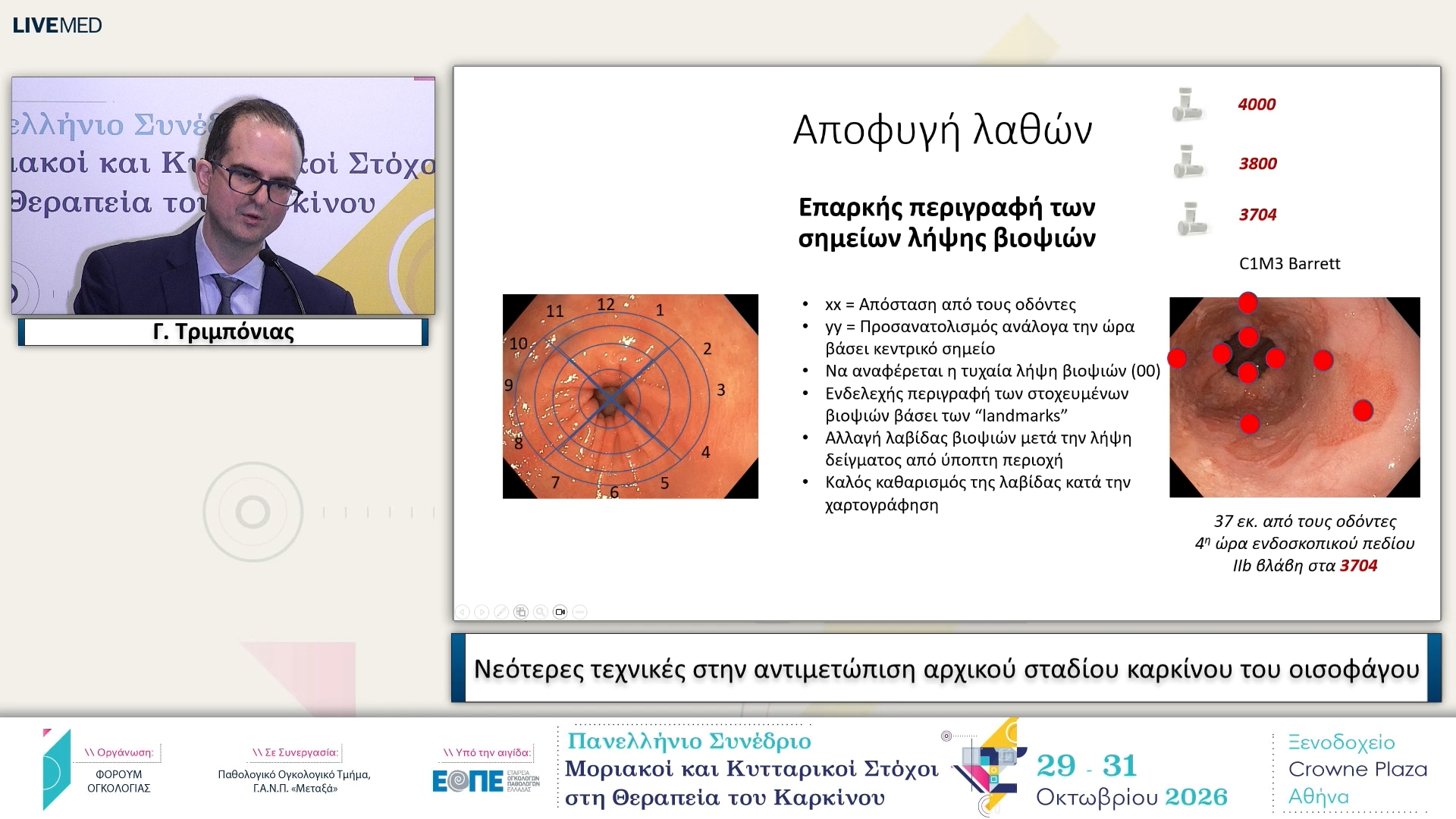 25 Γ. Τριμπόνιας - Νεότερες τεχνικές στην αντιμετώπιση αρχικού σταδίου καρκίνου του οισοφάγου. 