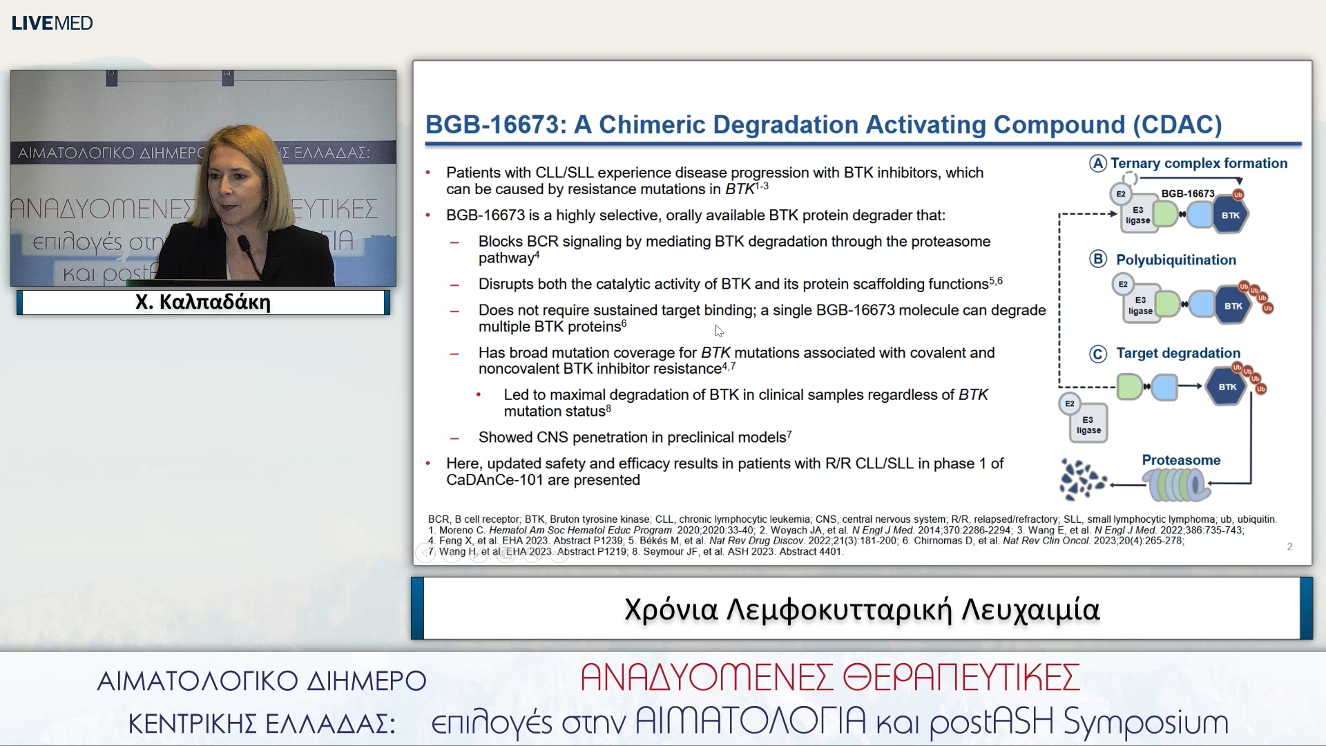 35 Χ. Καλπαδάκη - Χρόνια Λεμφοκυτταρική Λευχαιμία