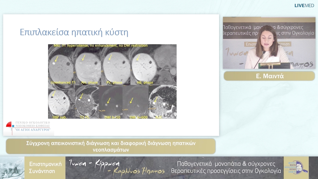38 Ε. Μαιντά - Σύγχρονη απεικονιστική διάγνωση και διαφορική διάγνωση ηπατικών νεοπλασμάτων 