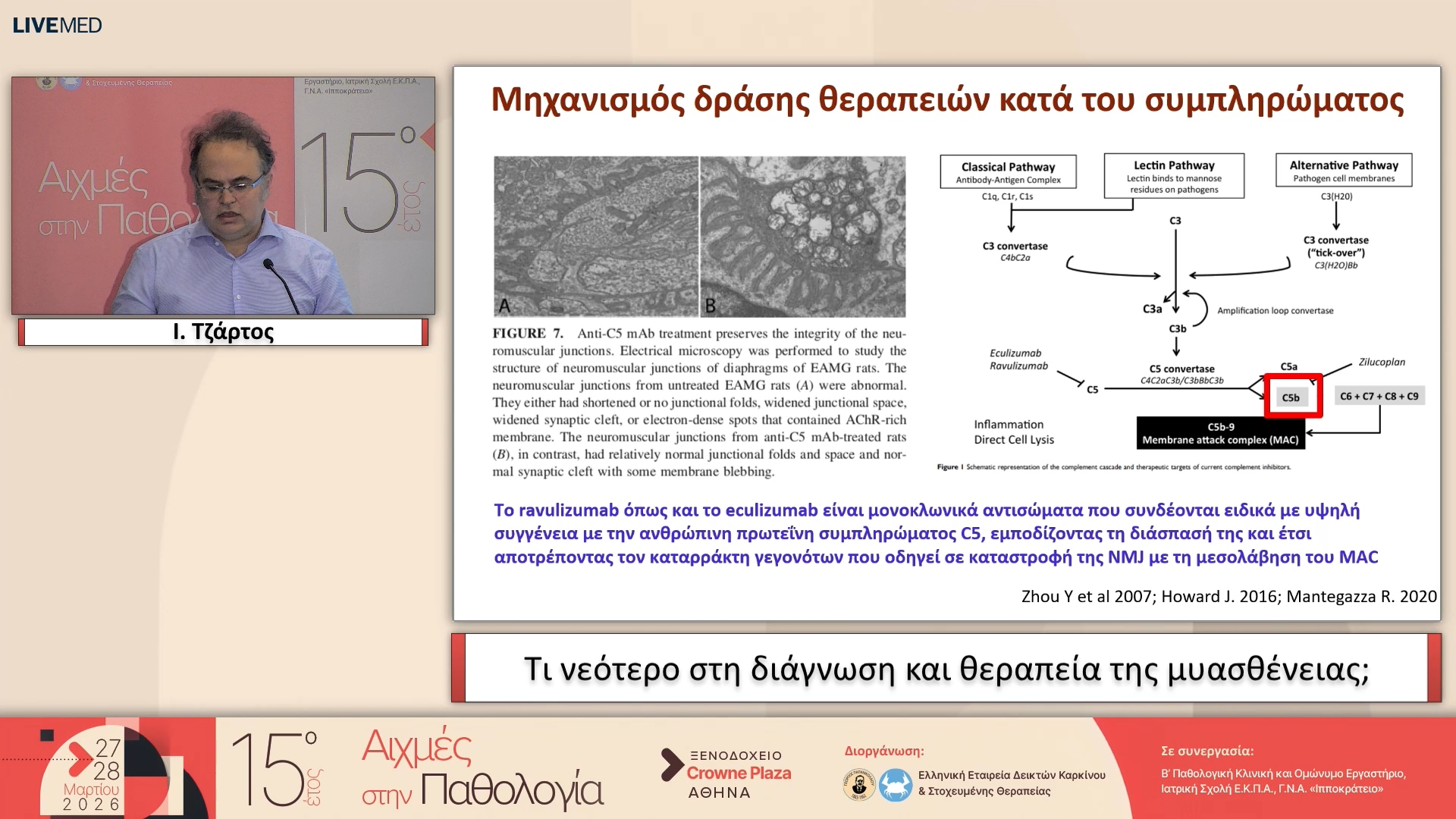 60 Ι. Τζάρτος - Τι νεότερο στη διάγνωση και θεραπεία της μυασθένειας;