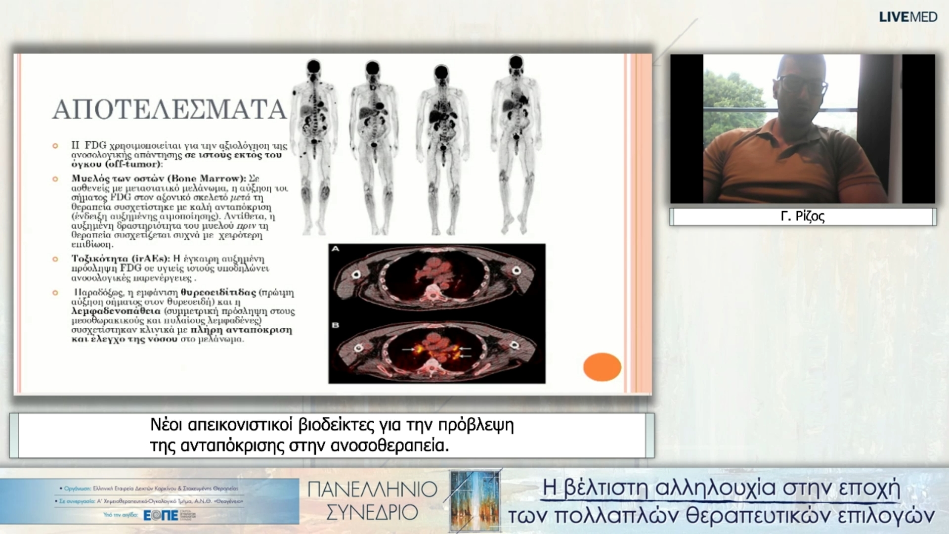 41 Γ. Ρίζος - Νέοι απεικονιστικοί βιοδείκτες για την πρόβλεψη της ανταπόκρισης στην ανοσοθεραπεία.