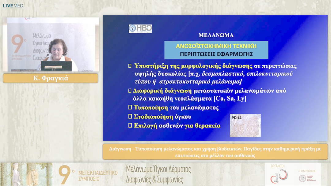 08 Κ. Φραγκιά - Διάγνωση - Τυποποίηση μελανώματος και χρήση βιοδεικτών. Παγίδες στην καθημερινή πράξη με επιπτώσεις στο μέλλον του ασθενούς