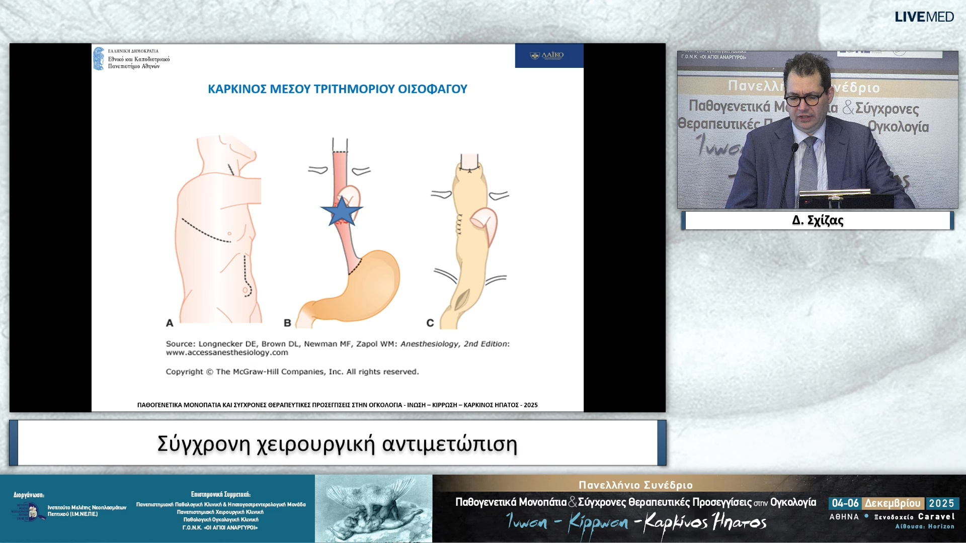 16 Δ. Σχίζας - Σύγχρονη χειρουργική αντιμετώπιση