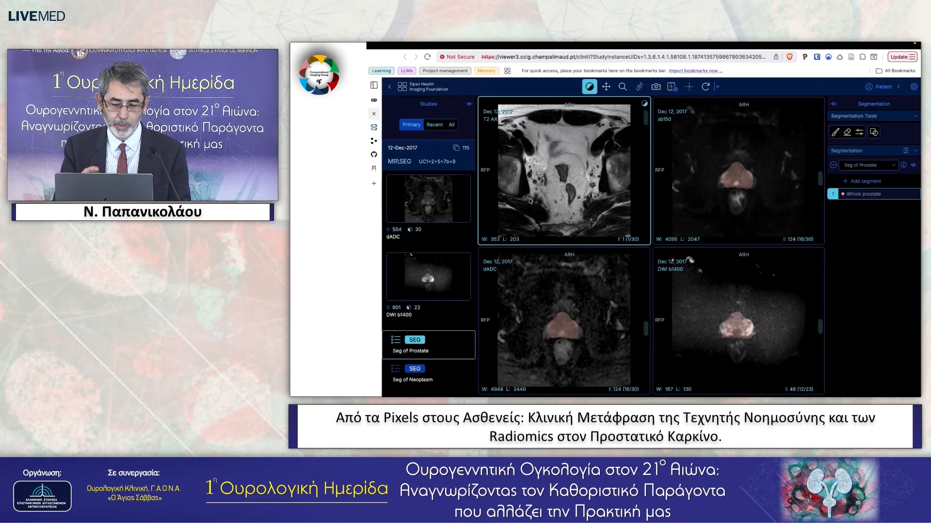 09 Ν. Παπανικολάου - Από τα Pixels στους Ασθενείς: Κλινική Μετάφραση της Τεχνητής Νοημοσύνης και των Radiomics στον Προστατικό Καρκίνο.