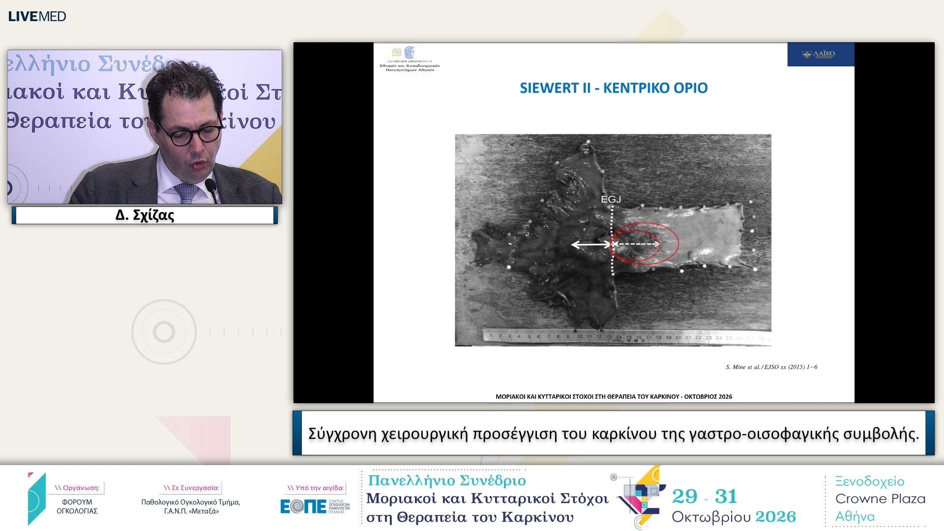 28 Δ. Σχίζας - Σύγχρονη χειρουργική προσέγγιση του καρκίνου της γαστρο-οισοφαγικής συμβολής.
