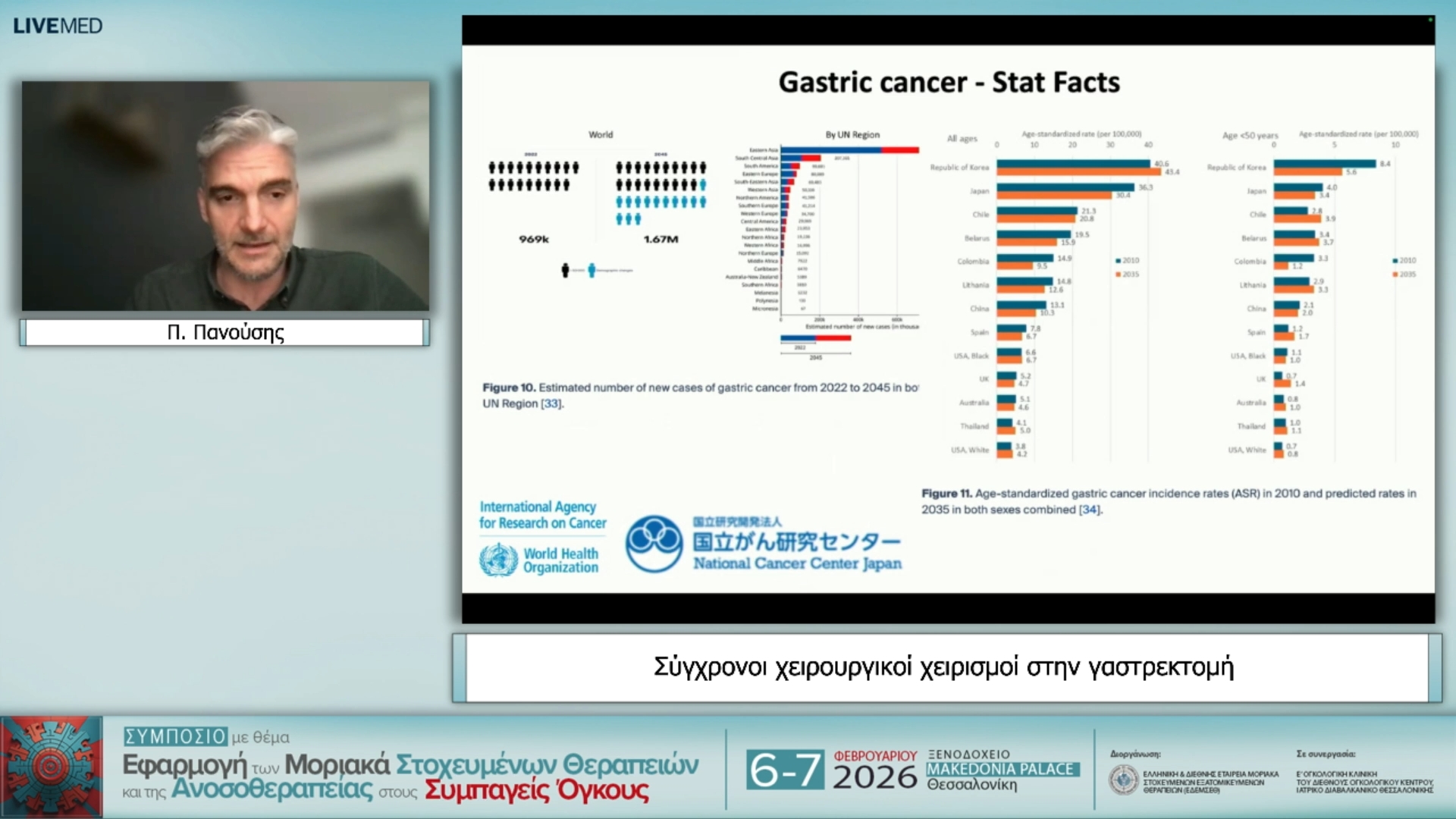 31 Π. Πανούσης - Σύγχρονοι χειρουργικοί χειρισμοί στην γαστρεκτοµή 