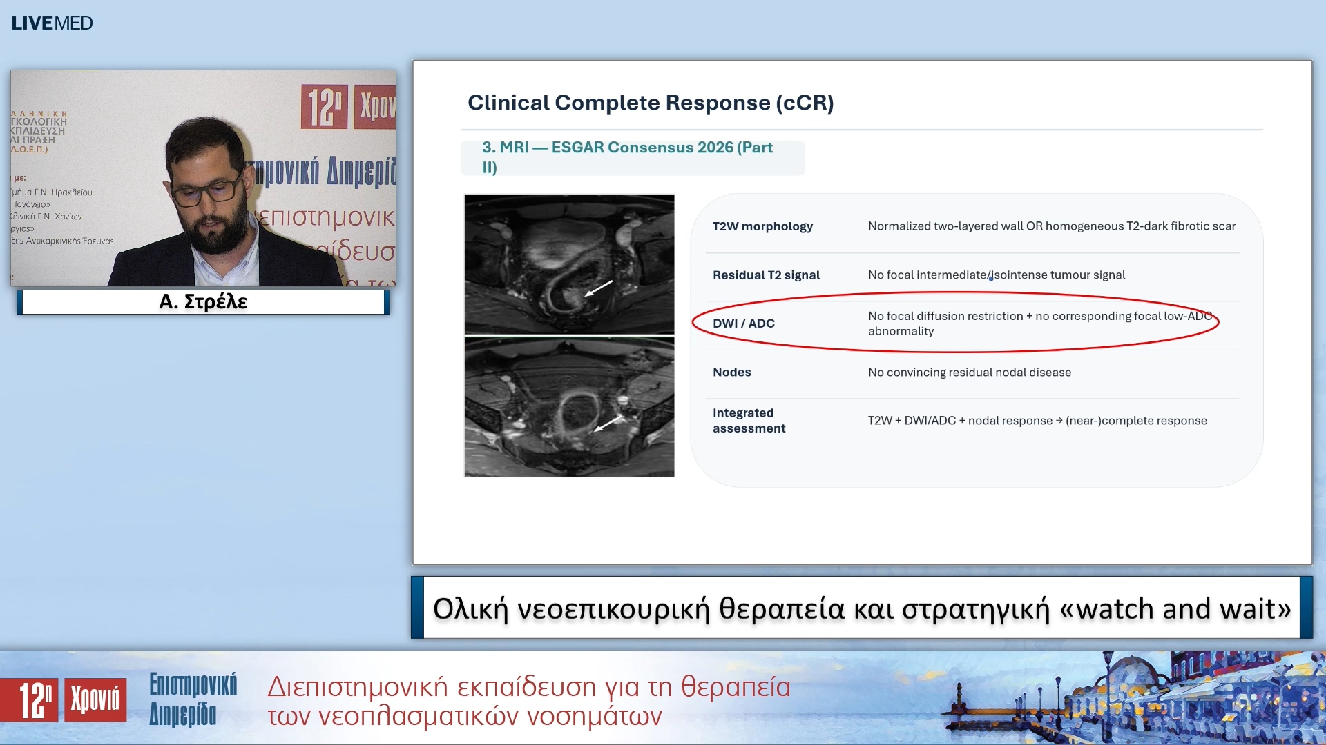 37 Α. Στρέλε - Ολική νεοεπικουρική θεραπεία και στρατηγική «watch and wait» 