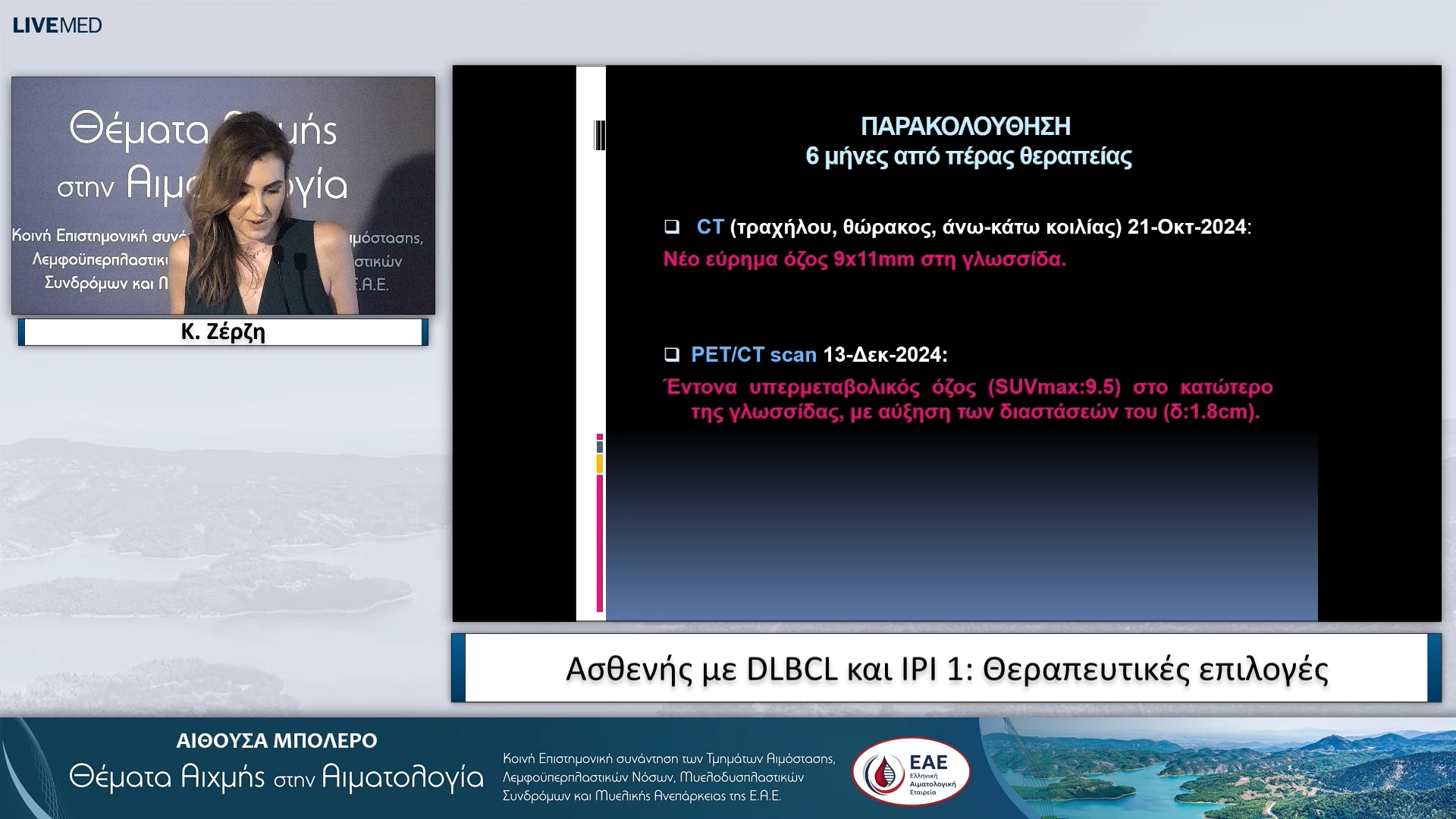 21  Κ. Ζέρζη, Λ. Μπενετάτος - Ασθενής με DLBCL και IPI 1: Θεραπευτικές επιλογές