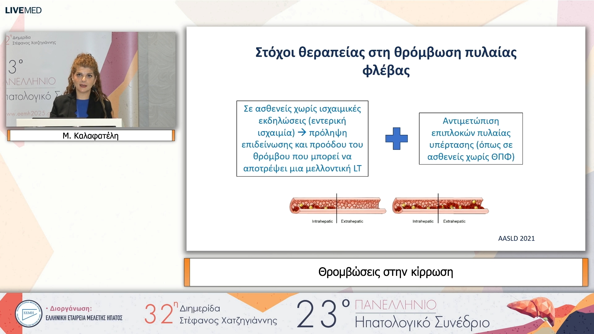 04 Μ. Καλαφατέλη - Θρομβώσεις στην κίρρωση