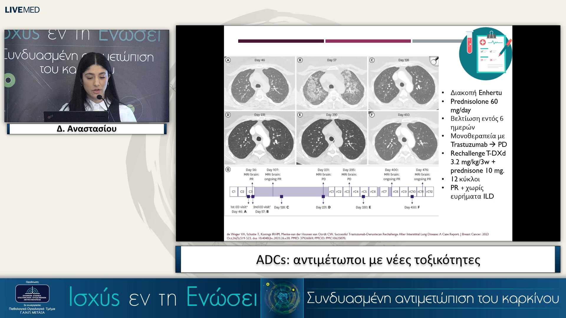 34 Δ. Αναστασίου - ADCs: αντιμέτωποι με νέες τοξικότητε