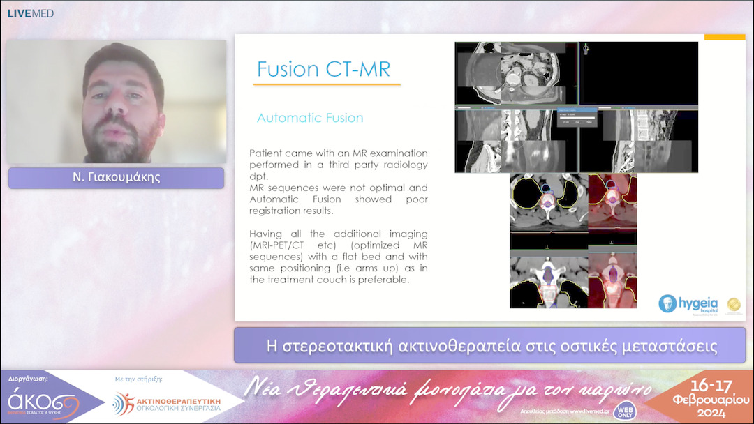 46 Ν. Γιακουμάκης - Η στερεοτακτική ακτινοθεραπεία στις οστικές μεταστάσεις 