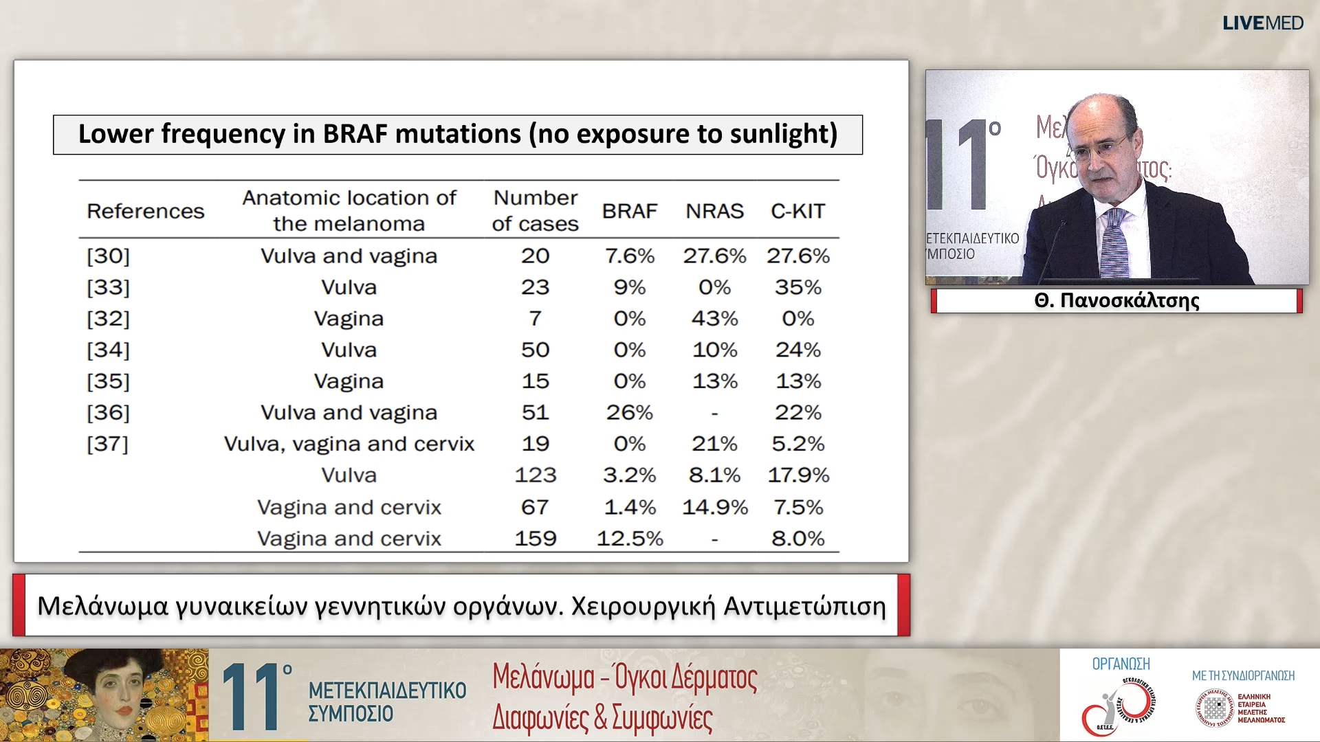 07 Θ. Πανοσκάλτσης - Μελάνωμα γυναικείων γεννητικών οργάνων Χειρουργική Αντιμετώπιση