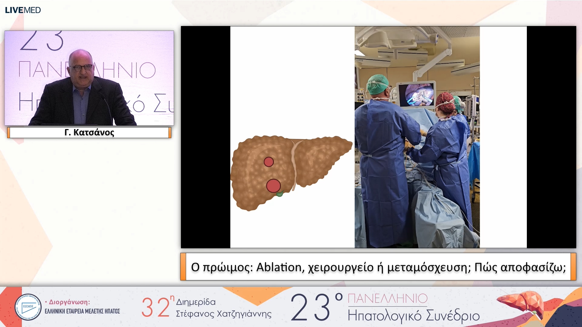 096 Γ. Κατσάνος - Ο πρώιμος: Ablation, χειρουργείο ή μεταμόσχευση; Πώς αποφασίζω;