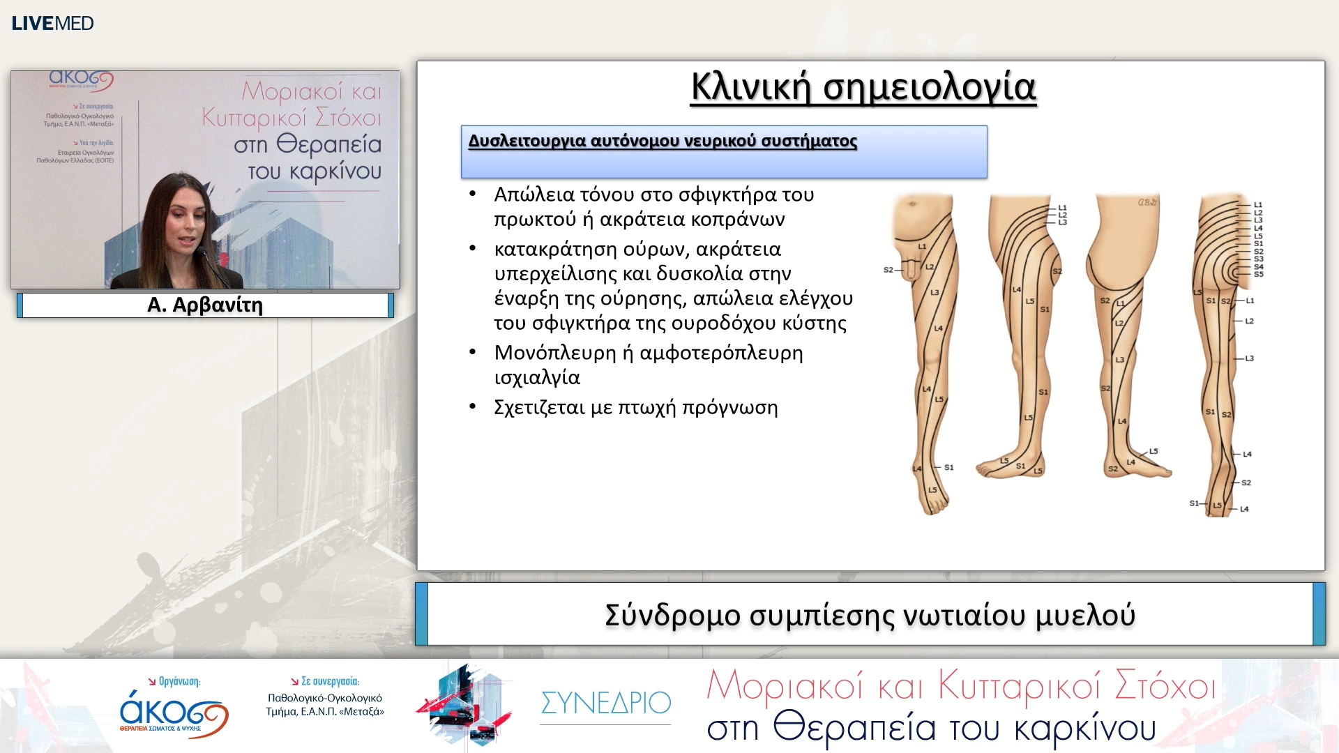 38 Α. Αρβανίτη - Σύνδρομο συμπίεσης νωτιαίου μυελού 