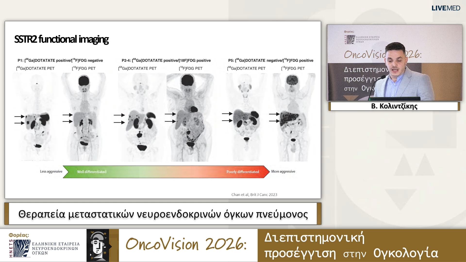 36 Β. Κολιντζίκης - Θεραπεία μεταστατικών νευροενδοκρινών όγκων πνεύμονος