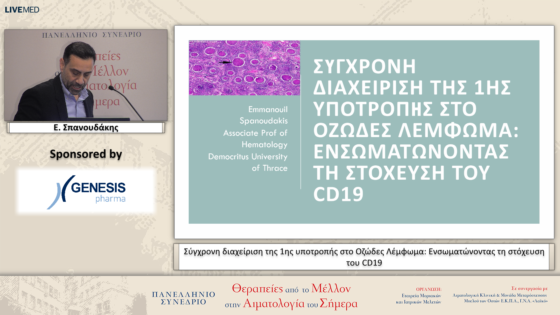 19 Ε. Σπανουδάκης - Σύγχρονη διαχείριση της 1ης υποτροπής στο Οζώδες Λέμφωμα: Ενσωματώνοντας τη στόχευση του CD19