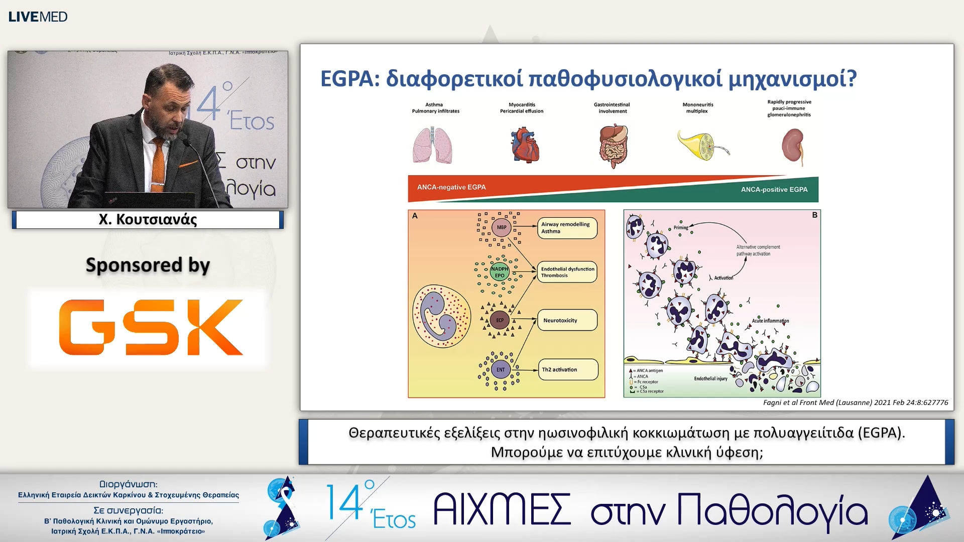 24 Χ. Κουτσιανάς - Θεραπευτικές εξελίξεις στην ηωσινοφιλική κοκκιωμάτωση με πολυαγγειίτιδα (EGPA). Μπορούμε να επιτύχουμε κλινική ύφεση; 