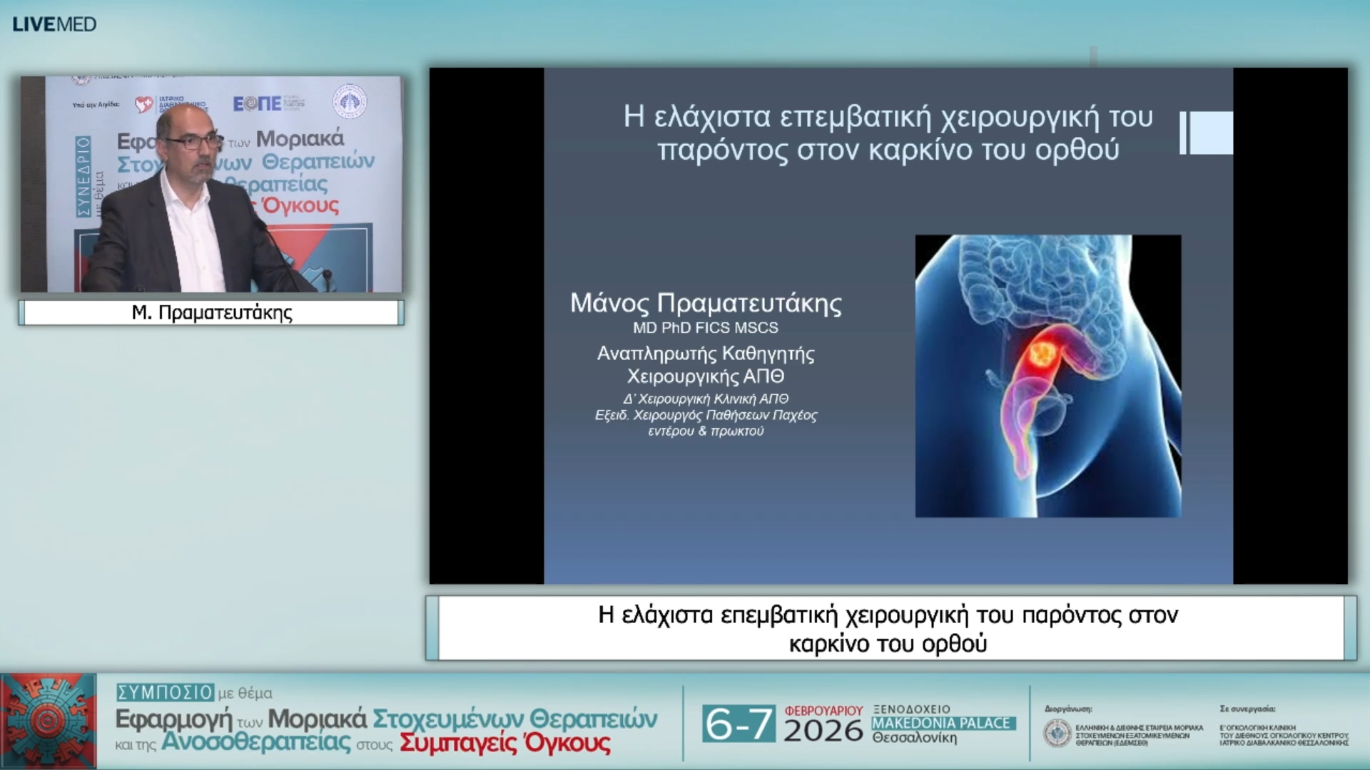 34 Μ. Πραματευτάκης - Η ελάχιστα επεμβατική χειρουργική του παρόντος στον καρκίνο του ορθού