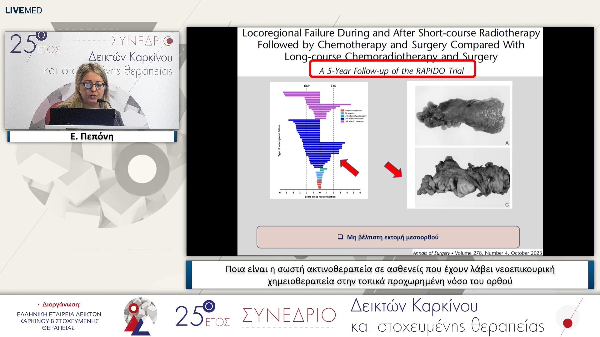 33 Ε. Πεπόνη - Ποια είναι η σωστή ακτινοθεραπεία σε ασθενείς που έχουν λάβει νεοεπικουρική χημειοθεραπεία στην τοπικά προχωρημένη νόσο του ορθού