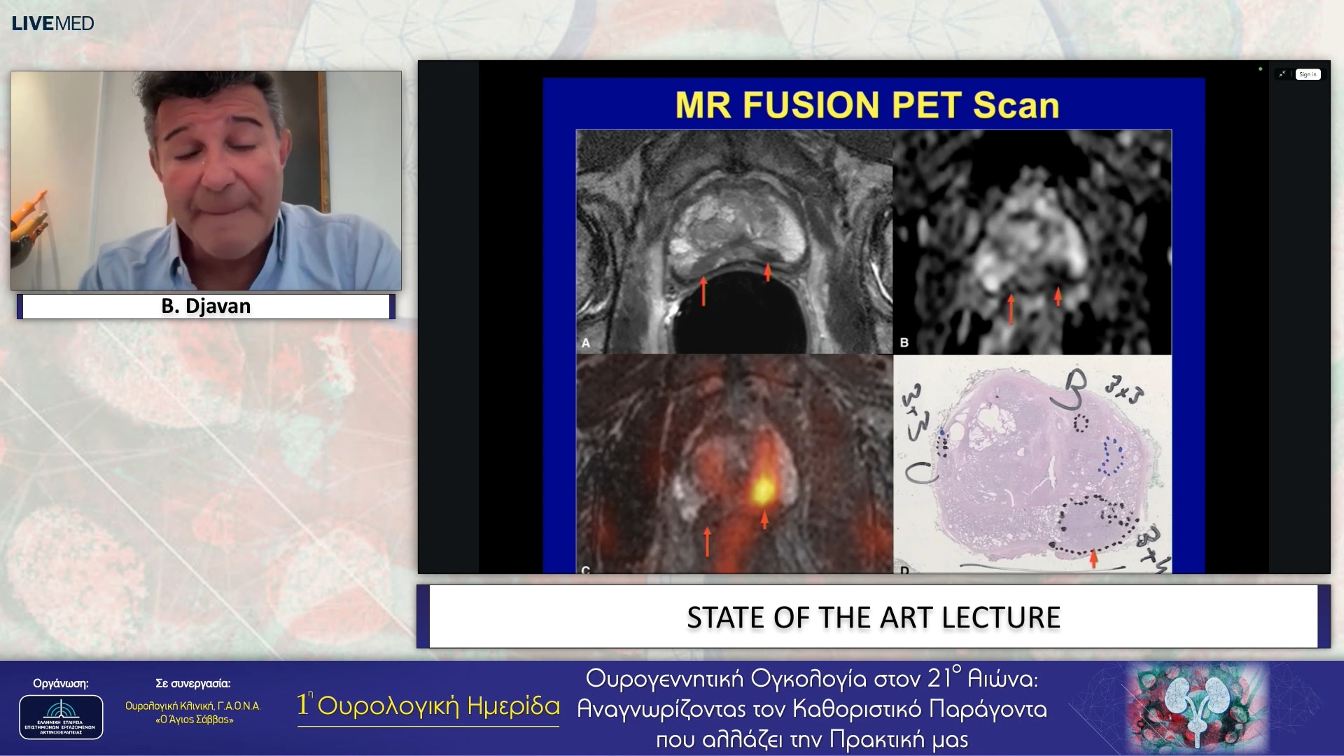05 B. Djavan - STATE OF THE ART LECTURE
