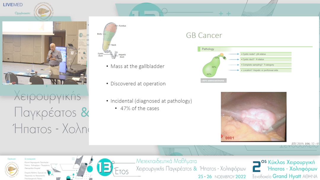 07 Χ. Δερβένης - Καρκίνος χοληδόχου κύστης