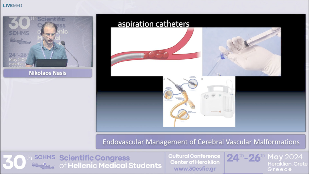 36 Nikolaos Nasis - Endovascular Management of Cerebral Vascular Malformations